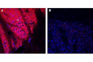 Expression of Dopamine Transporter (DAT) in rat striatum.