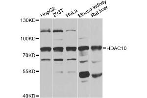 Western blot analysis of extracts of various cell lines, using HDAC10 antibody (ABIN5975007) at 1/1000 dilution. (HDAC10 Antikörper)