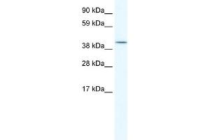 WB Suggested Anti-ISL2 Antibody Titration:  5.
