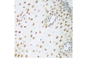 Immunohistochemistry of paraffin-embedded human esophagus using HDAC1 antibody (ABIN5970068) at dilution of 1/100 (40x lens). (HDAC1 Antikörper  (N-Term))