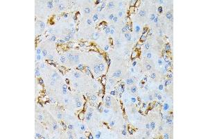 Immunohistochemistry of paraffin-embedded human liver using IQG Rabbit mAb (ABIN7268019) at dilution of 1:100 (40x lens). (IQGAP1 Antikörper)