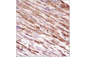 Immunohistochemistry (Paraffin-embedded Sections) (IHC (p)) image for anti-HSPA Binding Protein, Cytoplasmic Cochaperone 1 (HSPBP1) (AA 68-97), (N-Term) antibody (ABIN952805)