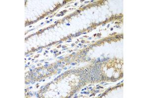 Immunohistochemistry of paraffin-embedded human stomach using PDIA3 antibody at dilution of 1:100 (40x lens). (PDIA3 Antikörper)