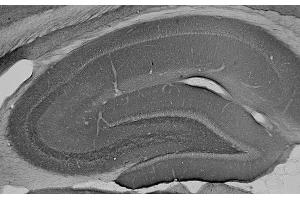 Adult rat hippocampus immunohistochemistry.