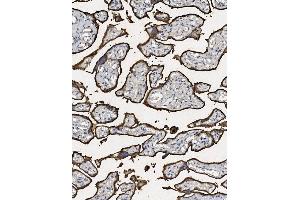 anti-Placental Alkaline Phosphatase (ALPP) (AA 403-433), (C-Term) antibody