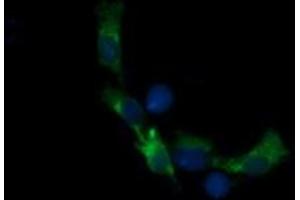 Image no. 3 for anti-Retinoic Acid Receptor Responder (Tazarotene Induced) 1 (RARRES1) antibody (ABIN1500601) (RARRES1 Antikörper)