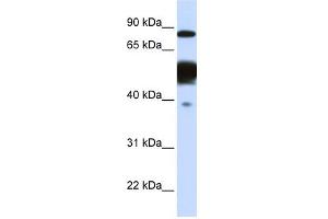 Nexilin antibody used at 1 ug/ml to detect target protein.