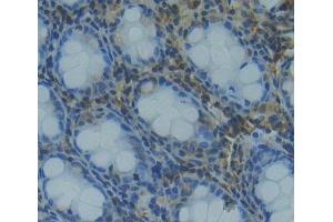 Immunohistochemistry (IHC) image for anti-Transcription Elongation Factor B (SIII), Polypeptide 1 (15kDa, Elongin C) (TCEB1) (AA 1-112) antibody (ABIN7445219)