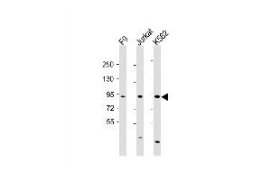 Western Blot at 1:2000 dilution Lane 1: F9 whole cell lysate Lane 2: Jurkat whole cell lysate Lane 3: K562 whole cell lysate Lysates/proteins at 20 ug per lane. (NUP93 Antikörper  (AA 20-54))