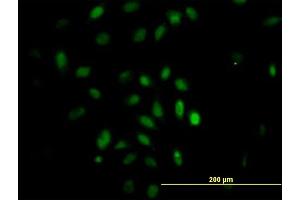 Immunofluorescence of monoclonal antibody to TRIM49 on HeLa cell. (TRIM49 Antikörper  (AA 251-340))