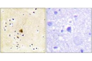 Immunohistochemistry analysis of paraffin-embedded human brain tissue, using RyR2 (Ab-2808) Antibody. (RYR2 Antikörper  (AA 2774-2823))