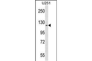 Western blot analysis in U251 cell line lysates (35ug/lane). (ATP13A2 Antikörper  (C-Term))