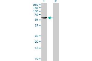 Western Blot analysis of FBXO4 expression in transfected 293T cell line by FBXO4 MaxPab polyclonal antibody. (FBXO4 Antikörper  (AA 1-387))
