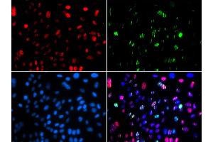 Immunofluorescence (IF) image for anti-Tumor Protein P53 (TP53) (pSer15) antibody (ABIN1870674) (p53 Antikörper  (pSer15))