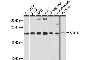 Western blot analysis of extracts of various cell lines, using R antibody (ABIN3016760, ABIN3016761, ABIN3016762 and ABIN6219834) at 1:1000 dilution. (RAB18 Antikörper  (AA 1-206))