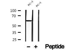 Western blot analysis of extracts of PC-3 cells, using DPP4 antibody. (DPP4 Antikörper  (C-Term))