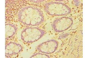 Immunohistochemistry of paraffin-embedded human colon tissue using ABIN7149358 at dilution of 1:100 (BMX Antikörper  (AA 65-280))