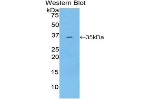 PDK4 anticorps  (AA 117-387)