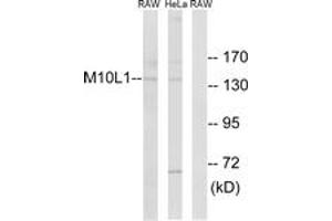 Western blot analysis of extracts from HeLa/RAW264. (MOV10L1 Antikörper  (AA 318-367))