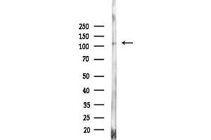 Western blot analysis of lysates from Hela cells(heat-shock,45 min treatment), using IPO9 Antibody at 1/1000 dilution.