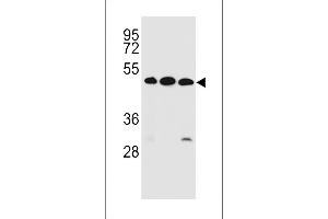 KREMEN2 Antibody (Center) (ABIN656978 and ABIN2846161) western blot analysis in ZR-75-1,K562,NCI- cell line lysates (35 μg/lane). (KREMEN2 Antikörper  (AA 248-276))