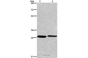 Western blot analysis of Hela and 293T cell, using CPSF4 Polyclonal Antibody at dilution of 1:400 (CPSF4 Antikörper)
