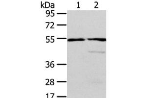 Western Blot analysis of Human normal liver and fetal liver tissue using ALDH3A2 Polyclonal Antibody at dilution of 1/250 (ALDH3A2 Antikörper)