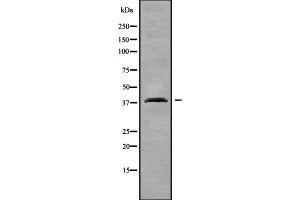 Western blot analysis OR2T4 using COLO205 whole cell lysates (OR2T4 Antikörper)