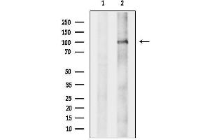 anti-DAZ Interacting Protein 1 (DZIP1) (C-Term) antibody