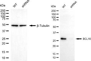 Western blotting analysis using BCL10 antibody (ABIN7797715). (BCL10 Antikörper)