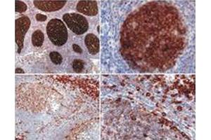 Immunohistochemistry staining (paraffin - embedded sections) using PAG1 monoclonal antibody, clone MEM - 255 . (PAG1 Antikörper  (AA 97-432))
