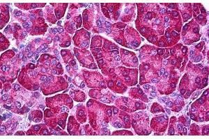 Human Pancreas: Formalin-Fixed, Parraffin-Embedded (FFPE) (Ferredoxin Reductase Antikörper)