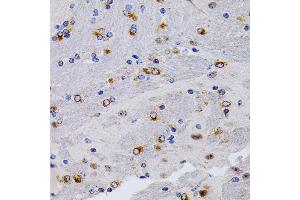 Immunohistochemistry of paraffin-embedded mouse brain using TFF1/pS2 antibody (ABIN3015565, ABIN3015566, ABIN3015567 and ABIN6218896) at dilution of 1:200 (40x lens). (TFF1 Antikörper  (pSer2))