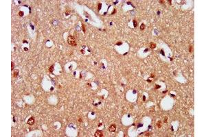 IHC image of ABIN7169728 diluted at 1:400 and staining in paraffin-embedded human brain tissue performed on a Leica BondTM system. (SIM2 Antikörper  (AA 347-433))