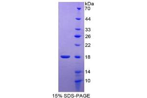 SDS-PAGE (SDS) image for Histone H2B Type 2-E (HIST2H2BE) (AA 2-126) protein (His tag) (ABIN1981255) (HIST2H2BE Protein (AA 2-126) (His tag))