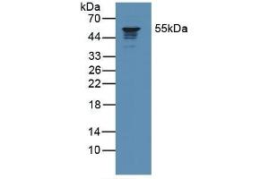 Coronin 1a antibody  (AA 7-204)
