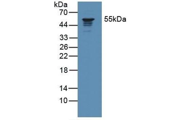 Coronin 1a Antikörper  (AA 7-204)