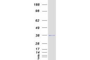 Western Blotting (WB) image for Hairy/enhancer-of-Split Related with YRPW Motif 2 (HEY2) protein (Myc-DYKDDDDK Tag) (ABIN2722683)
