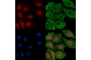 ABIN6257887 and ABIN6274270 staining Hela cells by IF/ICC.