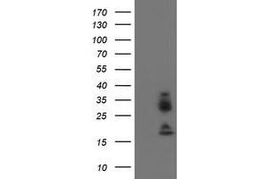 Western Blotting (WB) image for anti-Immunoglobulin J Polypeptide, Linker Protein For Immunoglobulin alpha and mu Polypeptides (IGJ) antibody (ABIN1498836) (IGJ Antikörper)