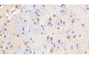 Detection of PR3 in Mouse Cerebrum Tissue using Polyclonal Antibody to Proteinase 3 (PR3) (PRTN3 Antikörper  (AA 24-249))