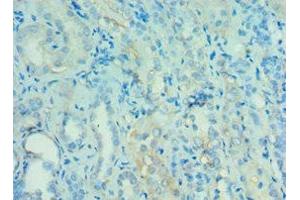 Immunohistochemistry of paraffin-embedded human kidney tissue using ABIN7144121 at dilution of 1:100 (ANGPTL4 Antikörper  (AA 26-406))