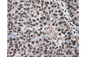 Immunohistochemical staining of paraffin-embedded colon tissue using anti-BSG mouse monoclonal antibody. (CD147 Antikörper)