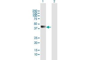 Western Blot analysis of PDGFD expression in transfected 293T cell line by PDGFD MaxPab polyclonal antibody. (PDGFD Antikörper  (AA 1-364))