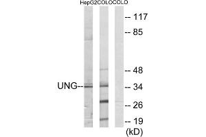 Western blot analysis of extracts from HepG2 cells and COLO cells, using UNG antibody. (UNG Antikörper  (Internal Region))