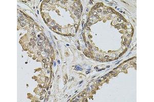 Immunohistochemistry of paraffin-embedded Human prostate using Cyclin A2 Polyclonal Antibody at dilution of 1:100 (40x lens). (Cyclin A Antikörper)