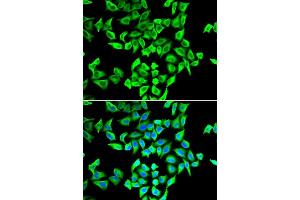 Immunofluorescence analysis of A549 cells using TP53 antibody. (p53 Antikörper  (AA 1-110))