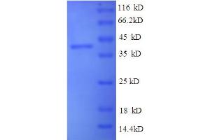 SDS-PAGE (SDS) image for Indolethylamine N-Methyltransferase (INMT) (AA 1-263), (full length) protein (His-SUMO Tag) (ABIN5709763)