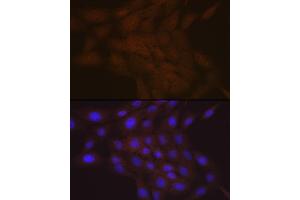 Immunofluorescence analysis of C6 cells using SMC4 Rabbit mAb (ABIN7270618) at dilution of 1:100 (40x lens). (SMC4 Antikörper)