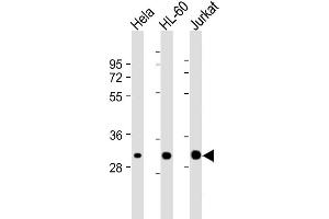 Lane 1: HeLa, Lane 2: HL-60, Lane 3: Jurkat cell lysate (20µg) probed with bsm-51309M CDK2 (1534CT665. (CDK2 Antikörper)